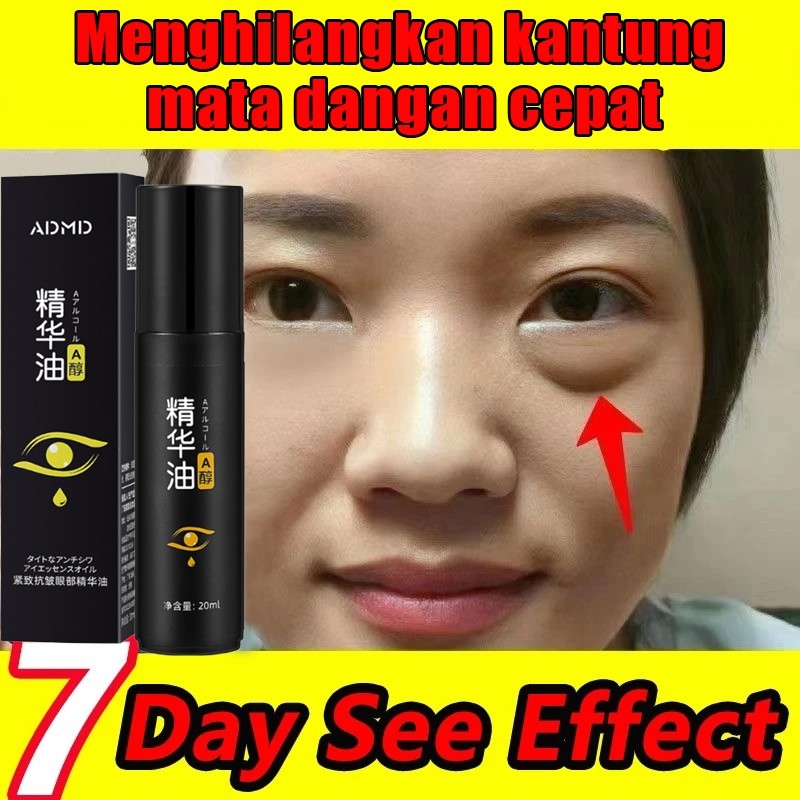 Serum Mata ADMD Cream 20ml Eye Cream Origina Menghilangkan Kantung Mata Dengan Cepat Krim Mata Anti 