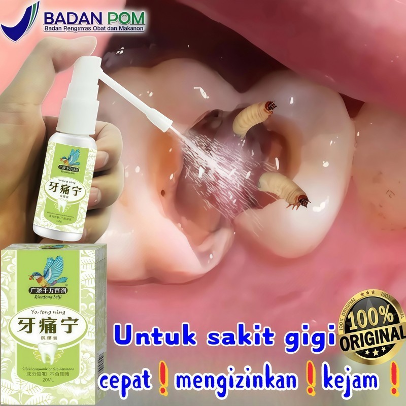 20ml Obat Sakit Gigi Semprotan Pereda Nyeri Sakit Gigi Pereda Sakit Gigi Semprot Oral Sakit Gigi Per