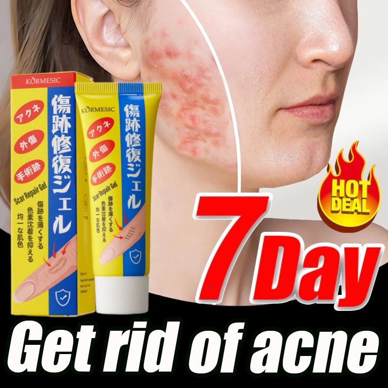 [ORI 100% ] Salep bekas luka Obat penghilang bekas luka Salep penghilang bekas luka bekas gigitan ny