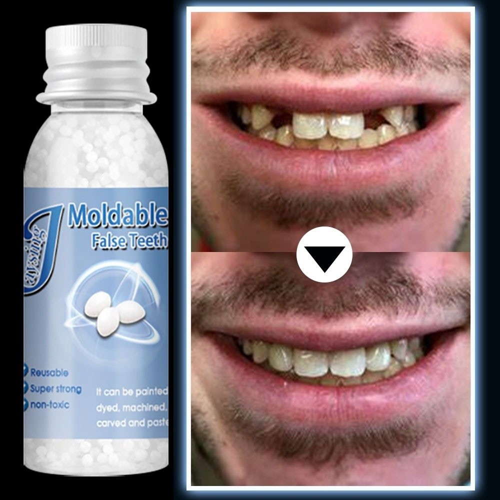 Penambal gigi berlubang Gigi Penambal Gigi Isi Gigi Palsu Penambal gigi berlubang Gigi palsu