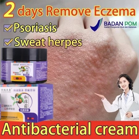 Salep Gatal Paling Krim Anti Gatal untuk Selangkangan Jamur Kurap Eksim Psoriasis 30g Krim Anti Gata