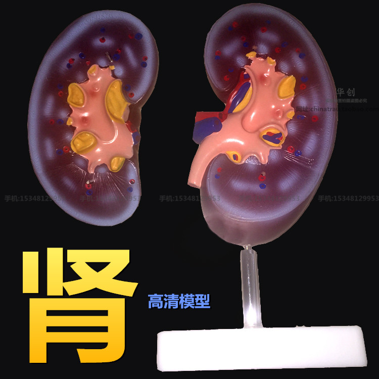 Medical kidney anatomy model of human medicine kidney ball section of tea ing and training of specia