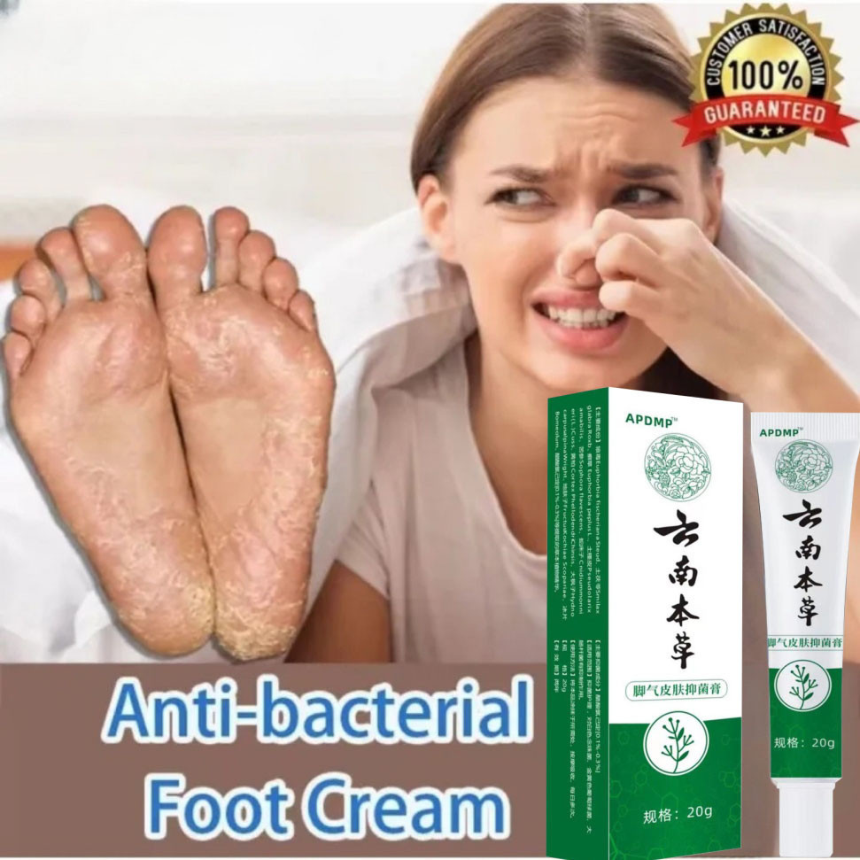 Beriberi Antibacterial Cream 20g Menghilangkan Jamur Tinea Pedis / Salep Perawatan Kaki / 100% Ori