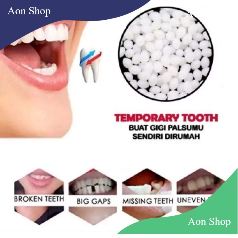 [AS] Penambal Gigi Ompong Temptooth Penambal Gigi Patah Instan / Gigi Palsu Instan / Diy Tooth