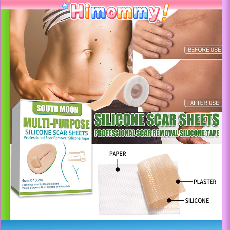 COD Silicone Scar Sheet 4cm X 1.5m Perawatan Keloid Operasi Stretch Mark /Tambalan Perbaikan Kulit /