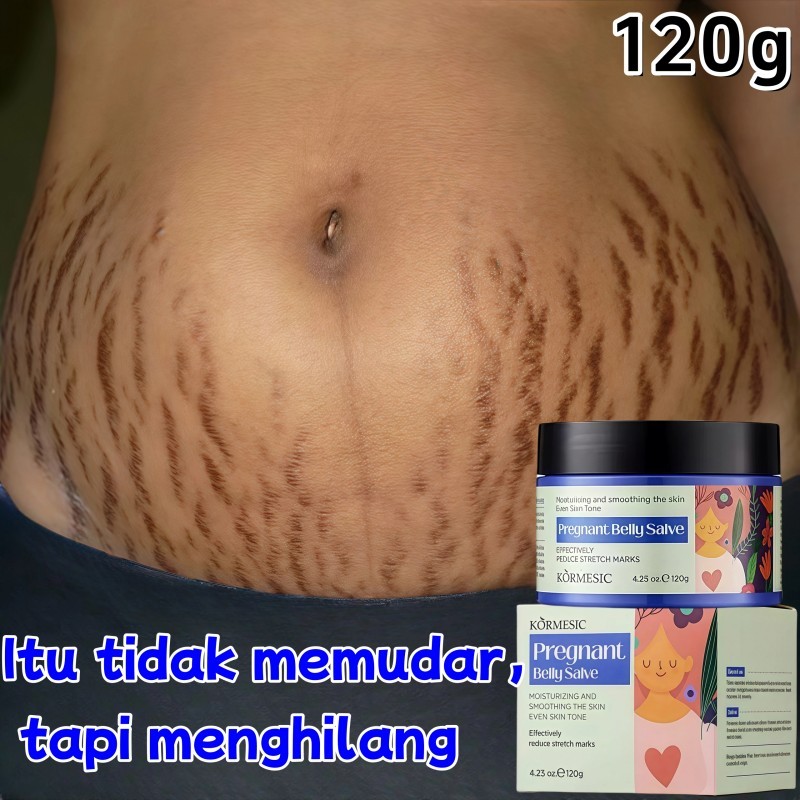 Krim Penghilang Stretch Mark 120g Stretch Marks Krim Penghilang Stretch Mark dan Lemak Krim Penghila