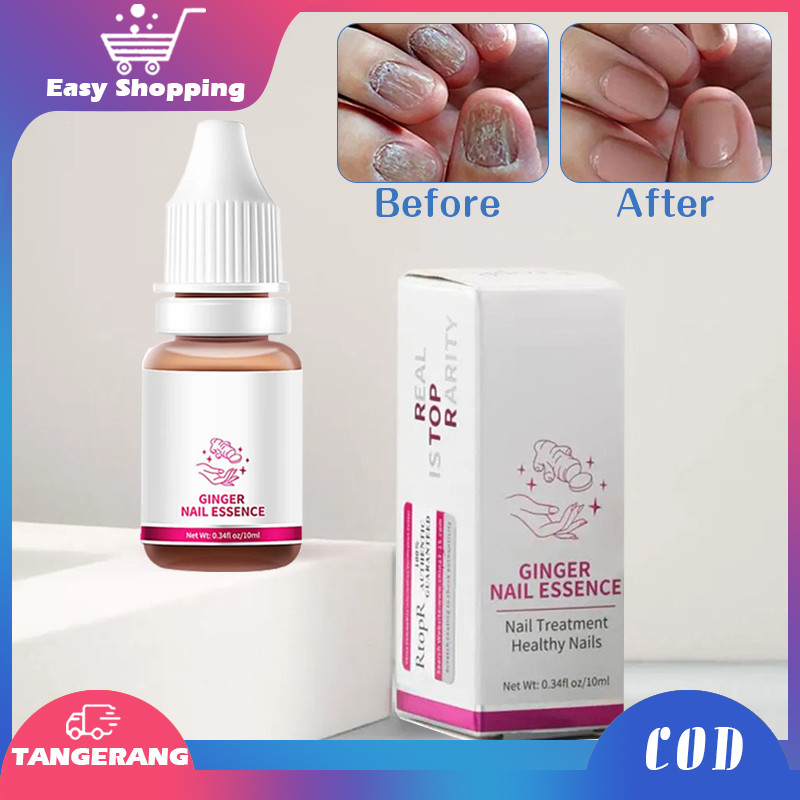 Perbaikan Kuku Nail Jamur Kuku Rusak Perawatan Kuku Rusak Obat Jamur Kuku 10ml