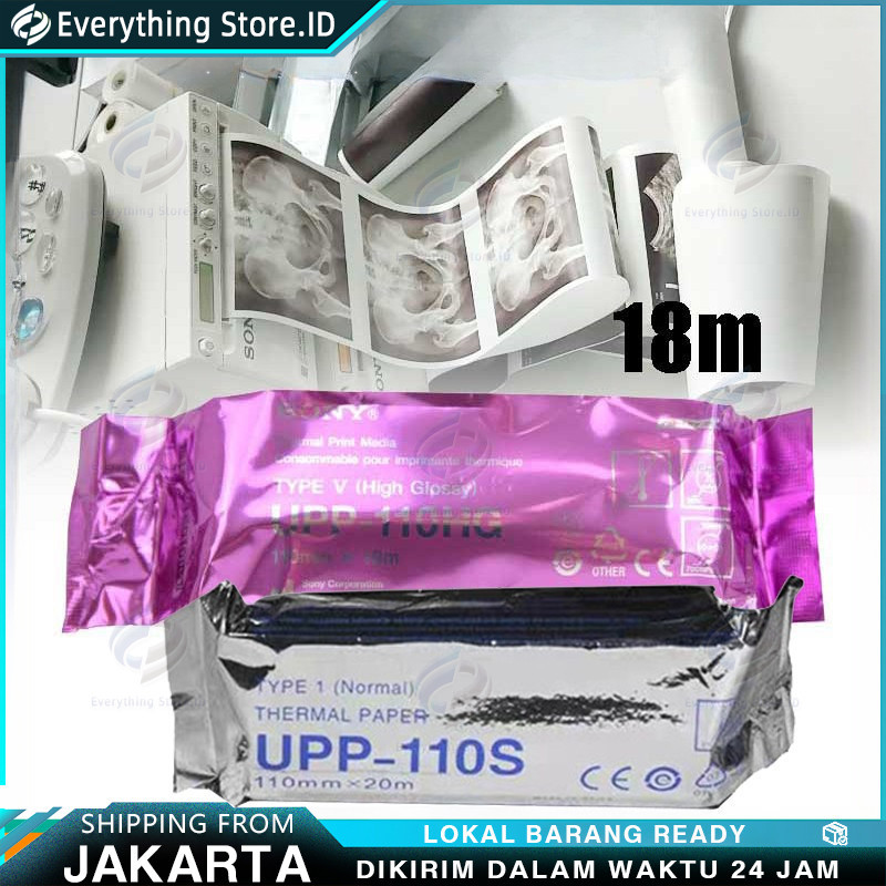 

Kertas USG Sony UPP 110HG / UPP 110S Printer USG Sony Paper Sony Type V High Glossy