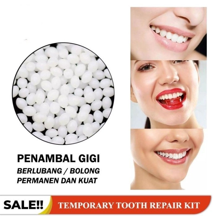 Gigi Palsu 100 Butir Penambal Gigi Patah Renggang Temporary Tooth Temptooth Gingsul Patah Kelinci / 