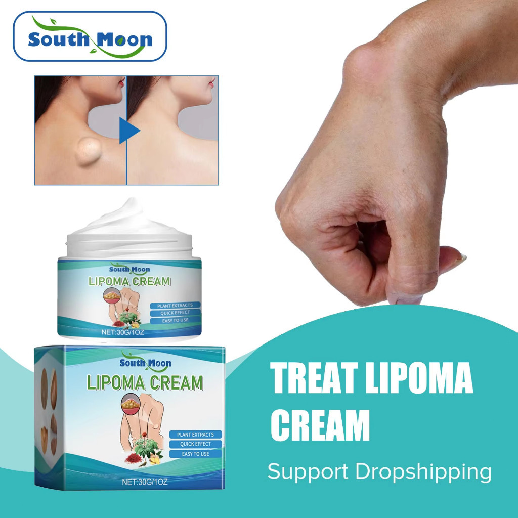 South Moon Lipoma Removal Cream 30g Herbal Cina Krim Obat Benjolan Lipoma Obat salep Lipoma Perawata