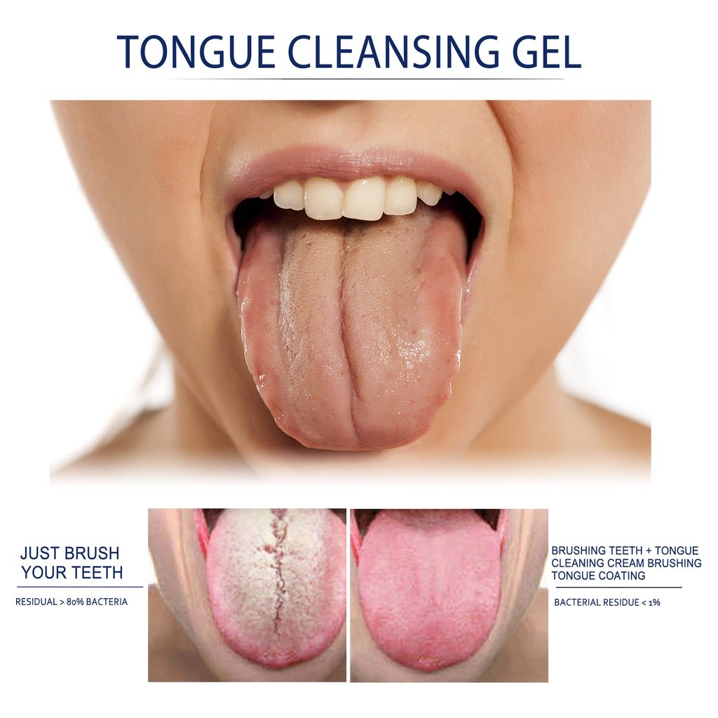 Gel Pembersih Lidah Tongue Cleaning Gel Lidah Putih Terasa Pahit Radang Lidah Lidah Kebas Propolis
