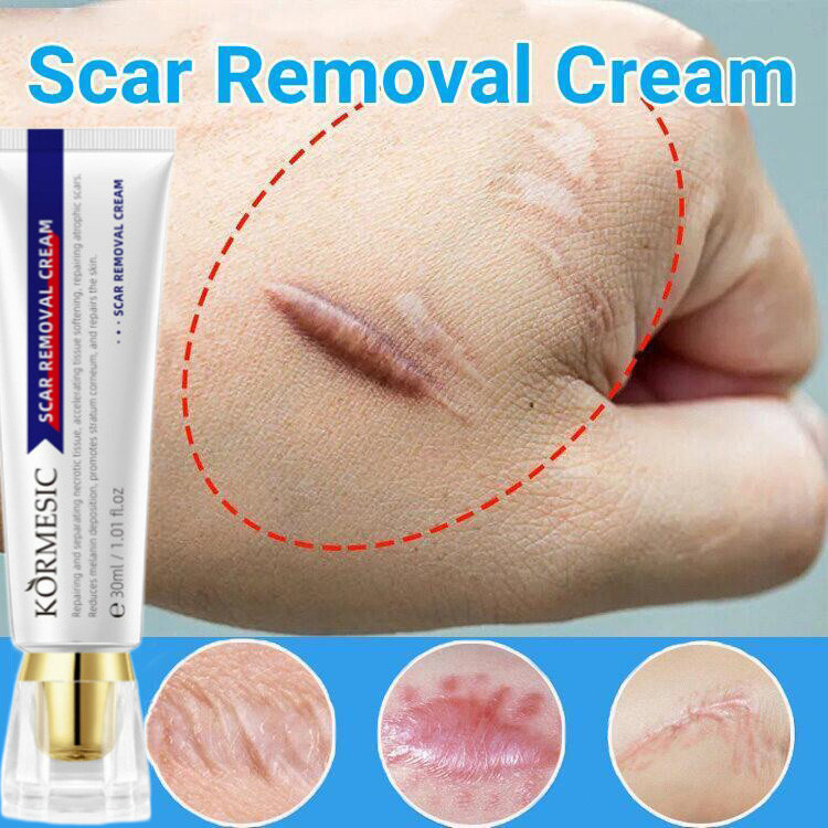 [ORI 100% ] Penghilang bekas luka Salep bekas luka Obat penghilang bekas luka Krim penghilang bekas 
