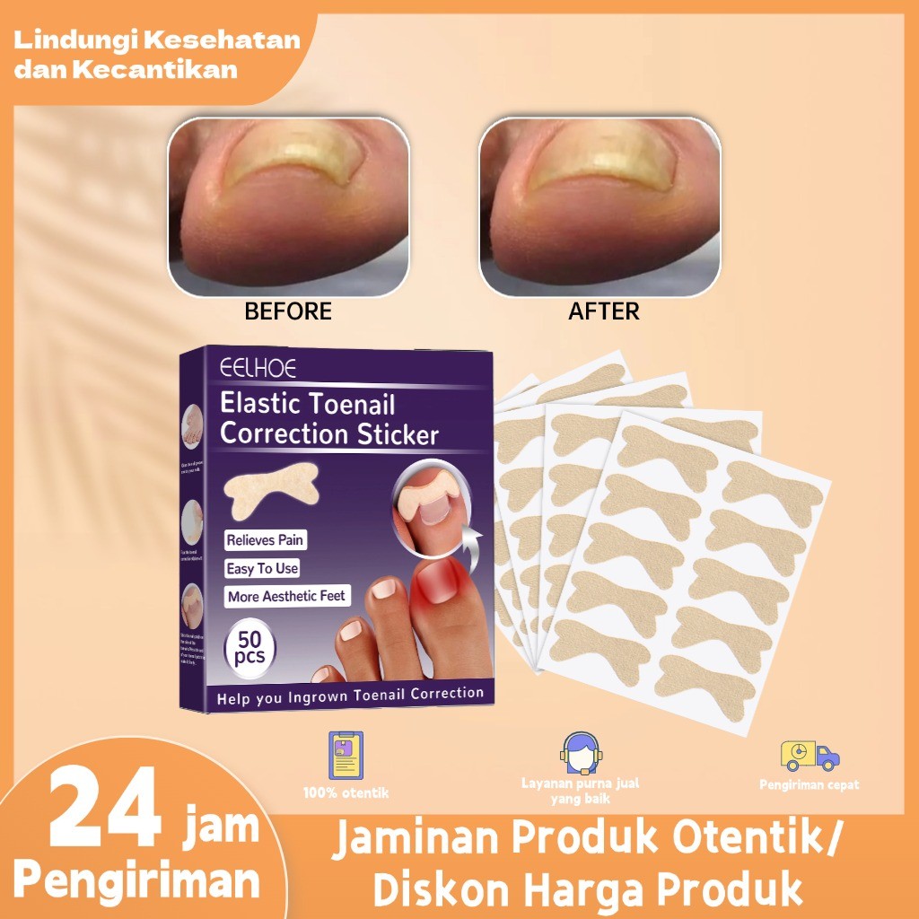 EELHOE elastic toenail sticker 50pcs  Nail Inserts Nail Groove Stiker Kuku Kaki  Nail Repair Ingrown