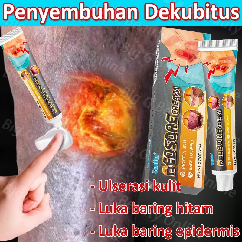 Krim Luka Baring Mengobati Dekubitus Penyembuhan Luka Khusus Kaki Busuk Pembusukan Obat Luka Diabete