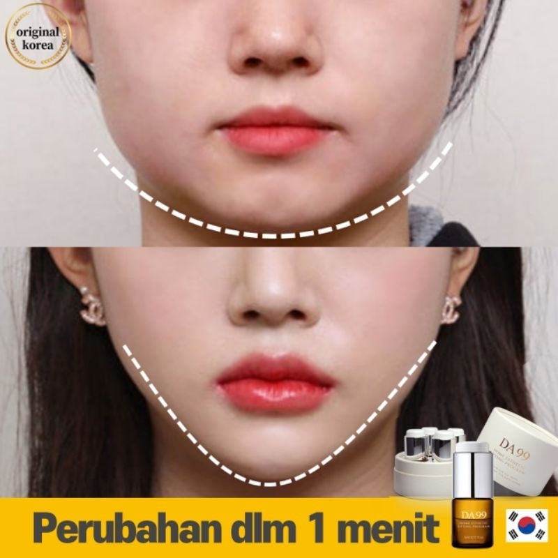 NEW DA99 Home Esthetic Lifting Serum / Wajah Pengencang / Tanam Benang No.1 Korea