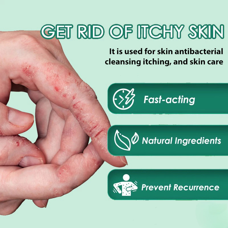 Salep Alergi Kulit Gatal Eksim Salep Gatal Kulit Ampuh Cina gatal selangkangan 30g Cocok untuk