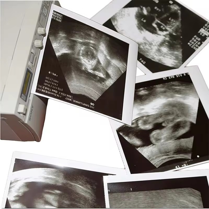 

Ay00! siappaper sony 110hg/ printer sony / Paper USG (High Glossy) Compatible / Kertas Sony UP-110HG