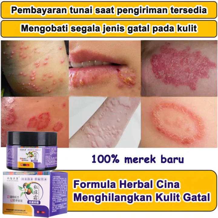 100% ORI   Salep Gatal Paling Ampuh Obat Gatal Paling Ampuh Salep Kulit Gatal Kulit Eksim Gatal Sela