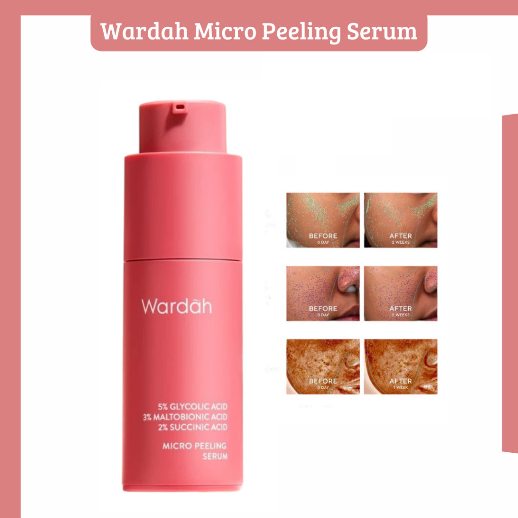 Wardah 5% Glycolic Acid Micro Peeling Serum 20ml - Serum Wajah