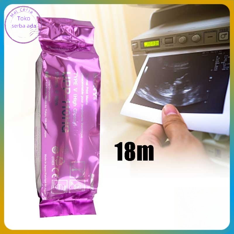 

Kertas USG Sony UPP 110HG Paper Sony Compatibel Printer USG