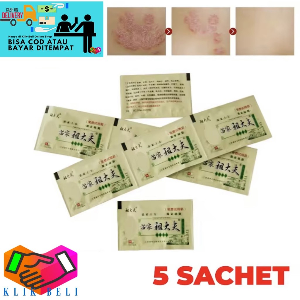 (5 PCS) Salep Zudaifu Sachet Krim Gatal Gatel Chy Gao Sasetan Eksim Exim Kurap Sachets Kudis Alergi