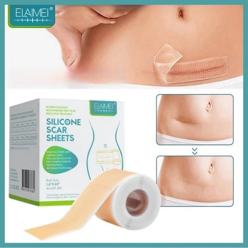 ELAIMEI Silicone Scar Sheet Gel Tube/Plester Silikon penghilang Bekas Luka/Silikon Plester Keloid Pe