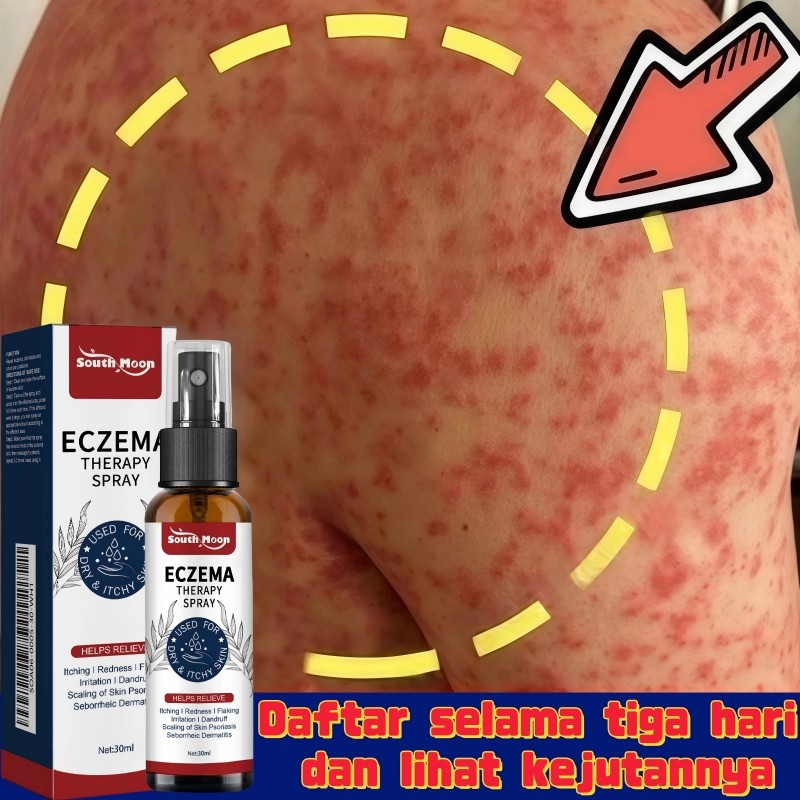 [100% asli] Semprotan anti gatal, semprotan eksim, obat psoriasis, semprotan psoriasis, obat gatal k
