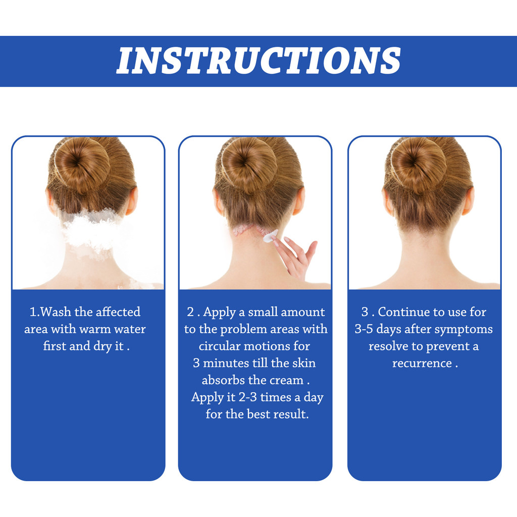 Rambut Psoriasis Perawatan Kulit Seboroik Perawatan Dermatitis Eksim Kepala Jerawat Pruritus Kulit