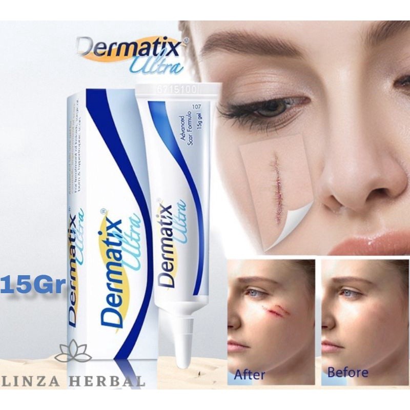 COD Dermatik Ultra / Dermatic / Dermatix Ultra 15Gr Cream Krim Penghilang Bekas Luka 15 gram strechm