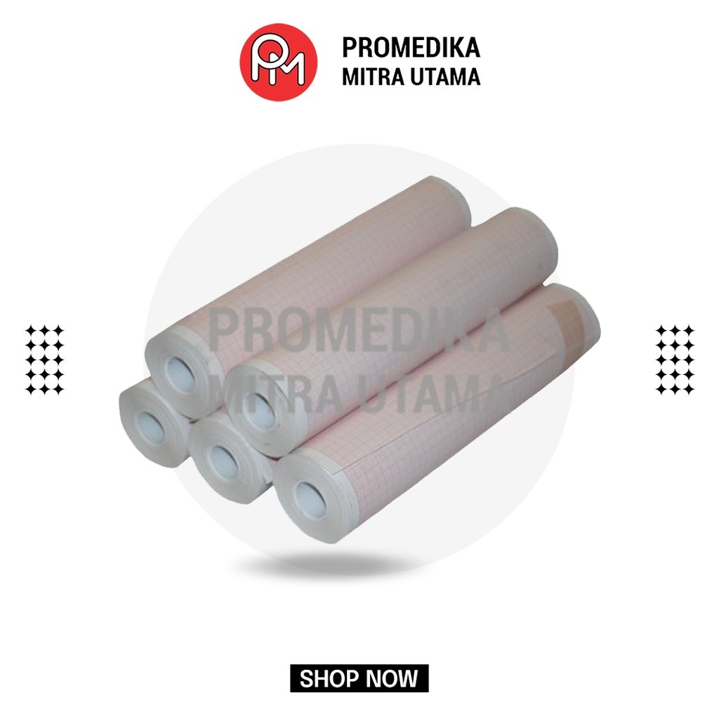 

Kertas Thermal | EKG Berbentuk Roll | Kertas Thermal Berbagai Ukuran dan Merk