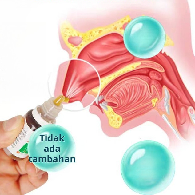 Obat sinusitis/Obat polip hidung/Nasal Spray 10ml/Sinusitis Nose/Terapi Kesehatan Terapi / 100% Asli