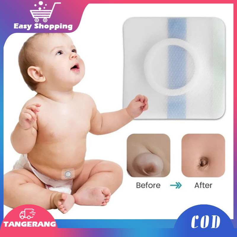 2pcs Koyo Hernia Anak Koyo Hernia Untuk Bayi Hernia Patch Bayi Bayi Sachet Plester Pusar