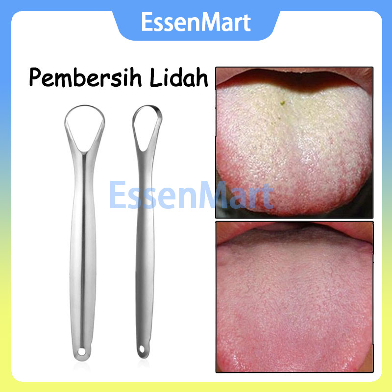 Scraper Pembersih Lidah / Sikat Pembersih Lidah Stainless Steel Reuseable Alat Pembersih Lidah Bau M