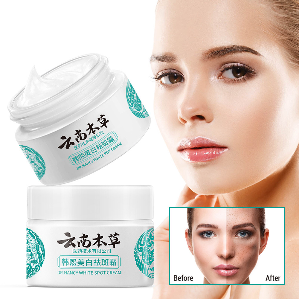 PREORDER Freckle Removal Cream 20g Whitening and Freckle Removing Cream Moisturizing Skin Removing F