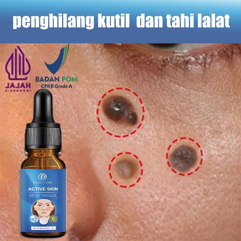 Penghilang kutil dan tahi lalat penghilang tahi lalat obat penghilang kutil 20ml penghilang kutil da