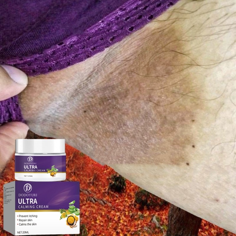 【BPOM】Obat gatel salep eksim salep gatal selangkangan salep gatal china paling ampuh 20g salep jamur