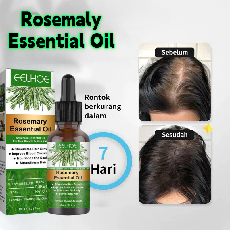 EELHOE Rosemary Oil Rambut Penumbuh Rambut Botak Perawatan Rambut Rontok Penumbuh Rambut Cepat Hair 