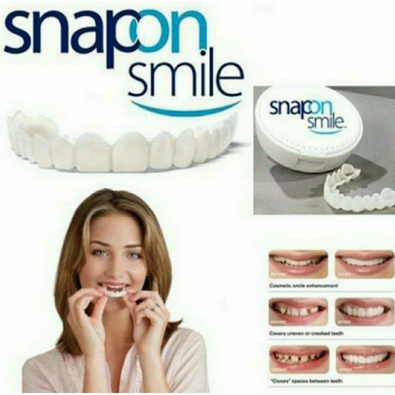 snap on smile original 100% SNAP ON SMILE Autentik Gigi Palsu Snap On Smile 1 set Veneer Gigi