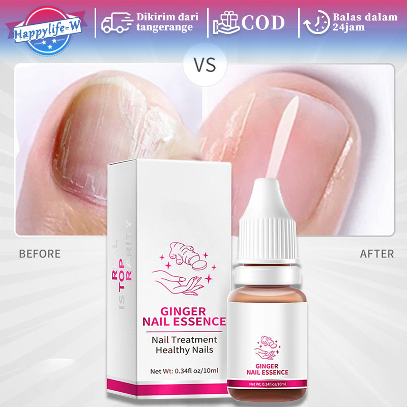 Nail Fungus Cream Kuku Jamur Dan Rusak Jamur Kuku Kaki Obat Kuku Ampuh Perawatan Kuku Rusak