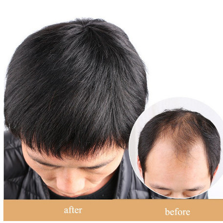 Wig Pria - Penutup kepala Botak - Wig Kepala Botak