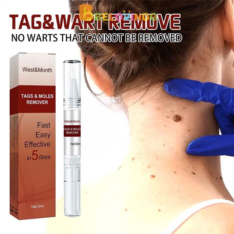 [ready️]Penghilang kutil Wart Remover Pen Penghilang Kutil Dan Tahi Skin tag remover-BE
