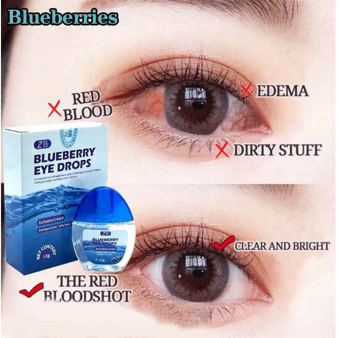 Blueberry Eye Drops 15g Tetes Mata Katarak Tetes Mata Softlens untuk Mata Kering Ketegangan Mata Oba