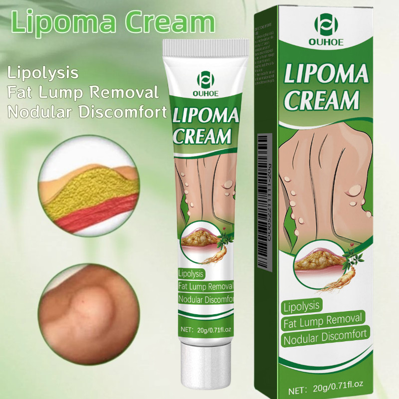 OUHOE Lipoma Cream Obat Benjolan Subkutan Lipoma Removal Cream Obat Salep Benjolan Lipoma Ampuh Herb