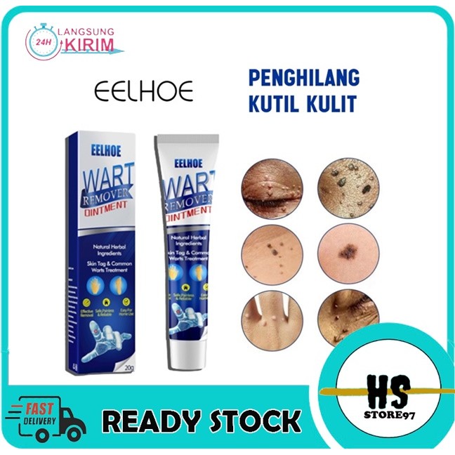 EELHOE Cream Skin Remover Wart Remover 20GR / Penghilang Tahi lalat Dan Perawatan Kutil