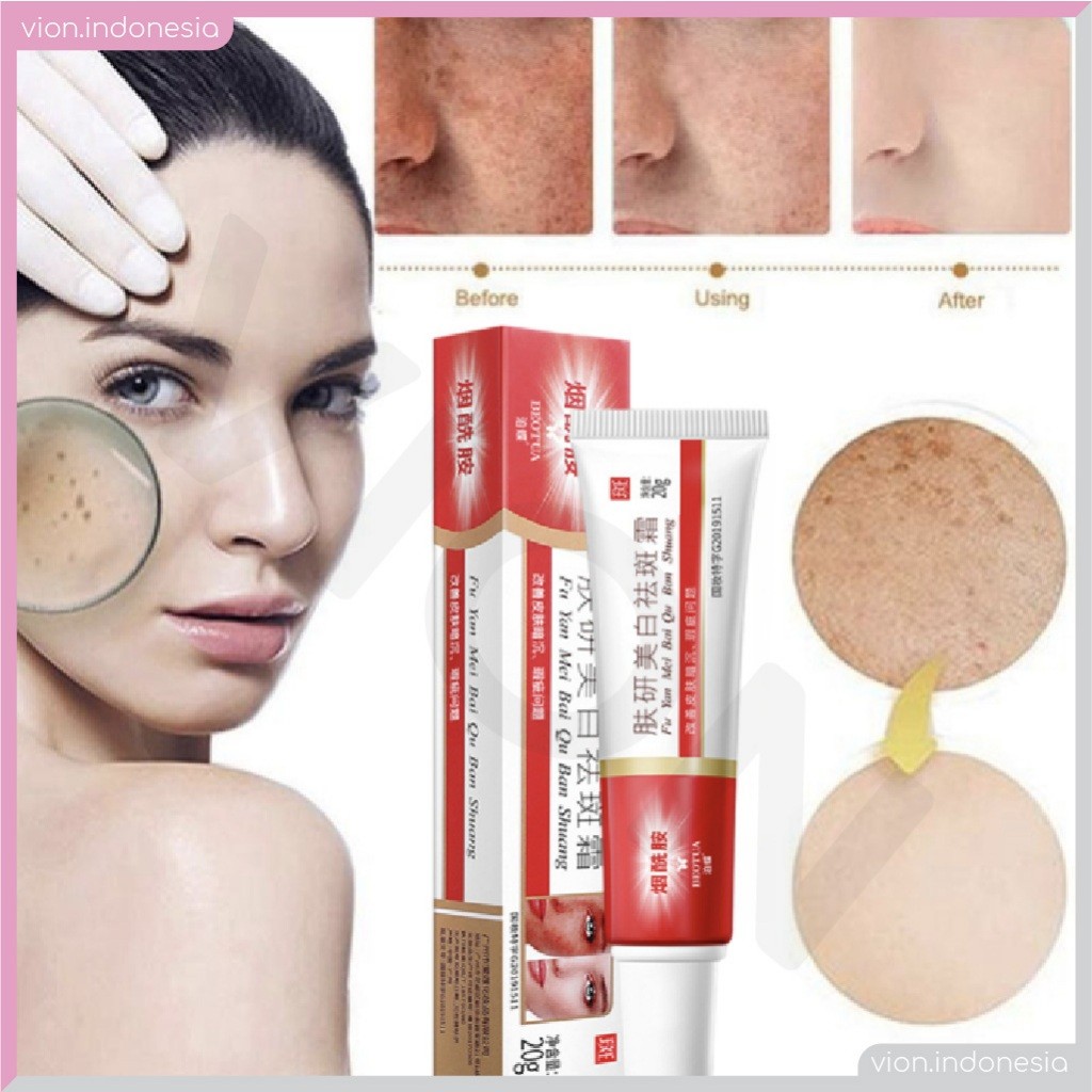 KACHI - BEOTUA Krim Penghilang Flek Hitam 20g - Salep Obat Fu Yan Mei Bai Qu Ban Shuang - Beo Tua Fr