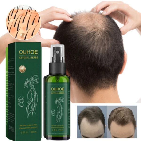 OUHOE HERBS ALAMI HAIRREGENERATION SPRAY Natural Herbs Hairregenration Spray Fast Hair Growth Serum 