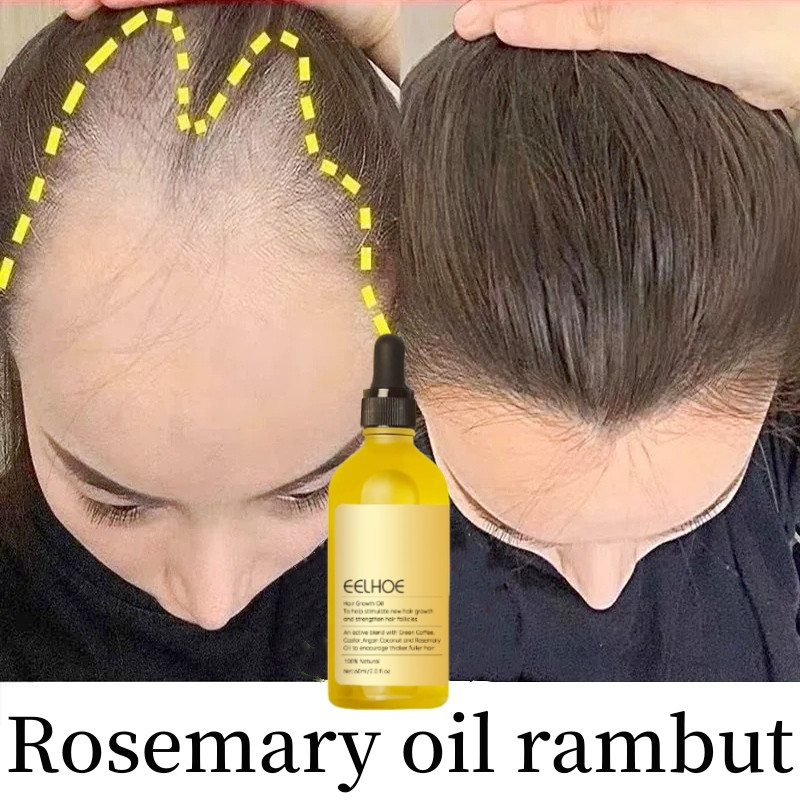Dr.MK-Rosemary oil rambut penumbuh rambut botak Anti rontok rambut Penumbuh rambut cepat dan tebal