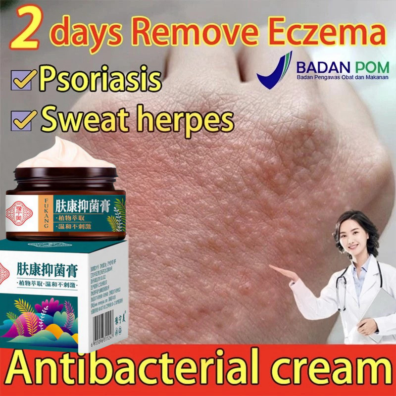 Salep Gatal Paling Ampuh Obat Gatal Paling Ampuh Salep Kulit Gatal Kulit Eksim Gatal Selangkangan Al