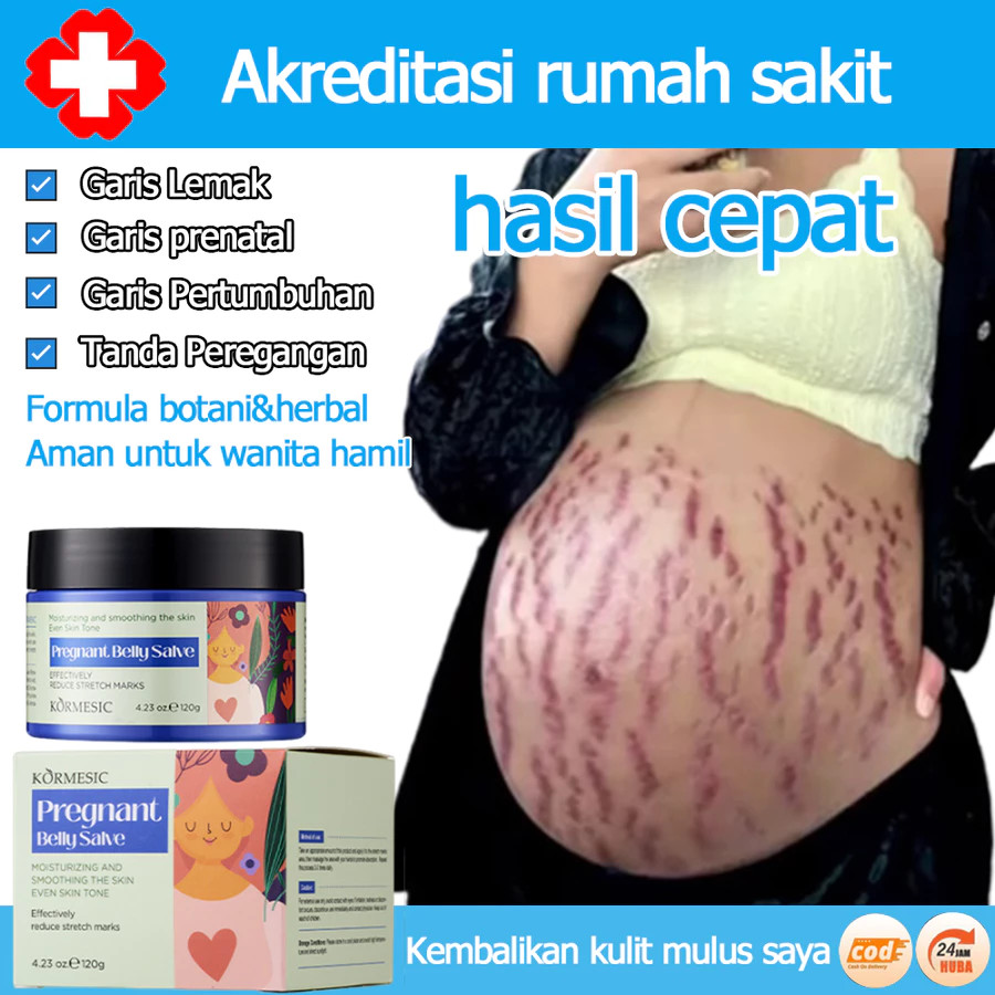 Krim Stretch Mark Herbal, Efektif Menghilang Stretch Mark, Garis