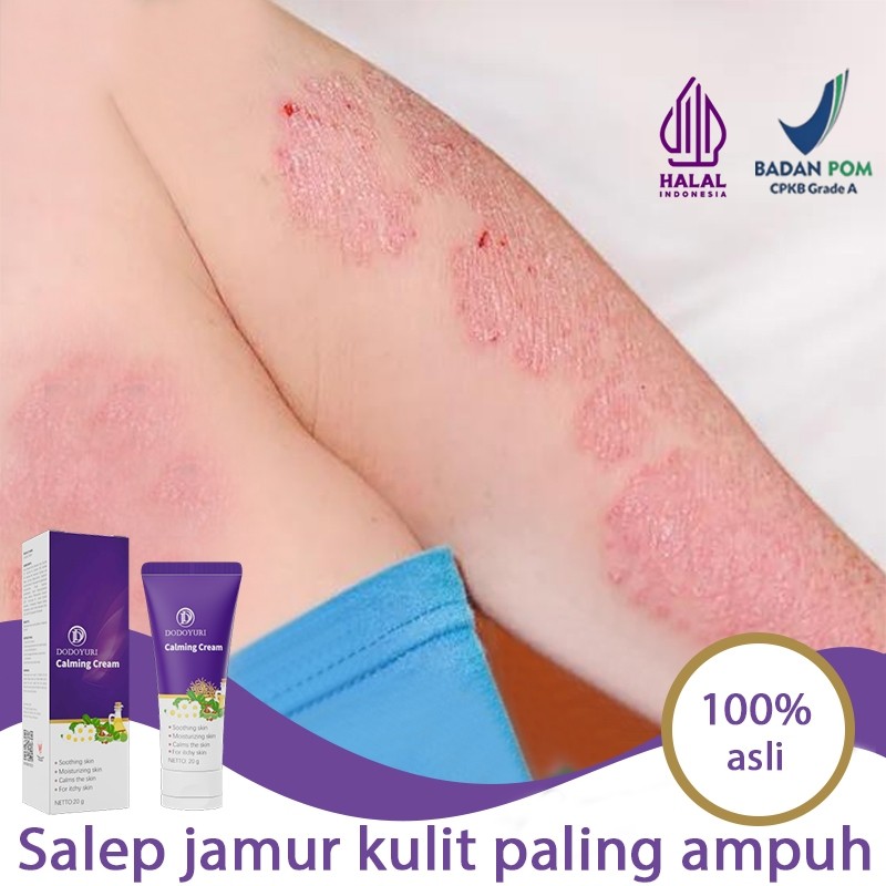 Salep gatal salep gatal china paling ampuh obat gatal selangkangan salep eksim paling ampuh 20g sale